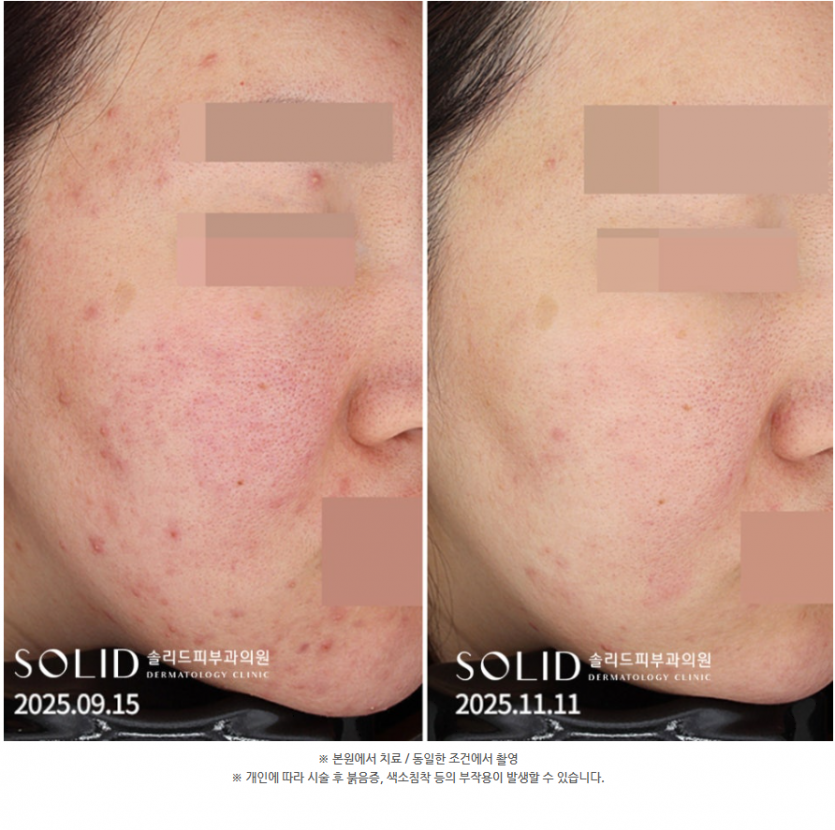 5bb71-6a8d815a62609-fa1b50b079f08f1a48fb4c7756e24c881d667ac1.png