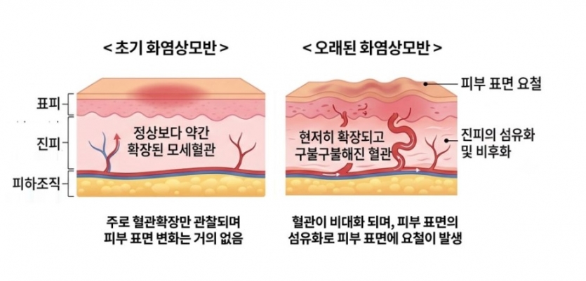 5bb71-6a97a09b45e6a-8a15c06eeb8b0d85a89347c53de302b74611097c.jpg